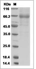 Canine IL20RA / IL-20RA Protein (Fc Tag) SDS-PAGE