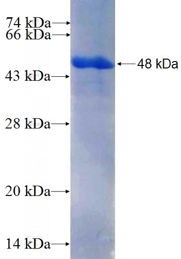 Recombinant Human PPP4R1 SDS-PAGE