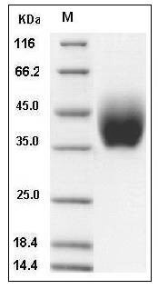 Mouse IL10RB / IL10R2 Protein (His Tag) SDS-PAGE