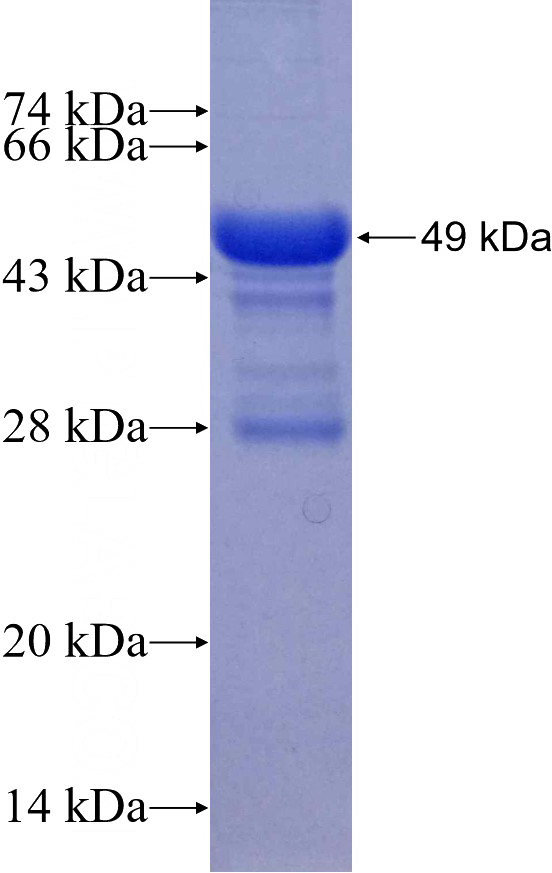 Recombinant Human DHX9 SDS-PAGE