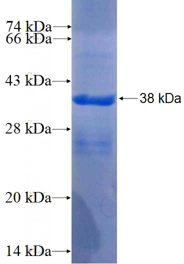 Recombinant Human PXDN SDS-PAGE