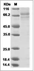 Influenza B (B/PHUKET/3073/2013) Hemagglutinin / HA0 Protein (full length)