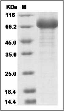 Human SIGLEC6 / CD327 Protein (Fc Tag) SDS-PAGE