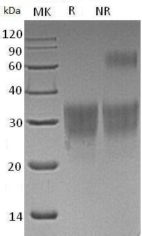 Human CD79B/B29/IGB (His tag) recombinant protein