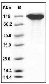 Mouse LIFR / CD118 Protein (His Tag) SDS-PAGE