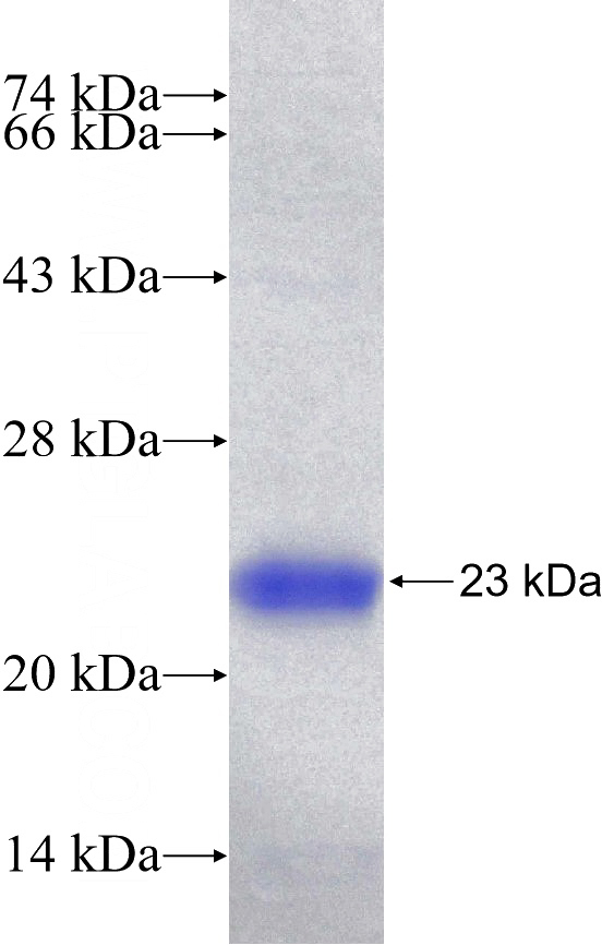 Human XPO5 Recombinant protein (6*His tag)
