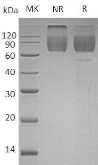 Mouse Cd86 (Fc tag) recombinant protein