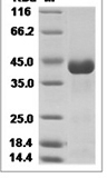 CHIKV E2 glycoprotein / CHIKV-E2 Protein 14759