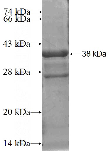 Recombinant Human PTMS SDS-PAGE