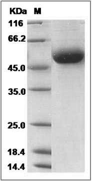 Rat DDR1 Kinase / MCK10 / CD167 Protein (His Tag) SDS-PAGE