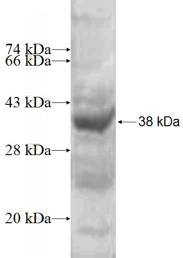 Recombinant Human GTPBP4 SDS-PAGE