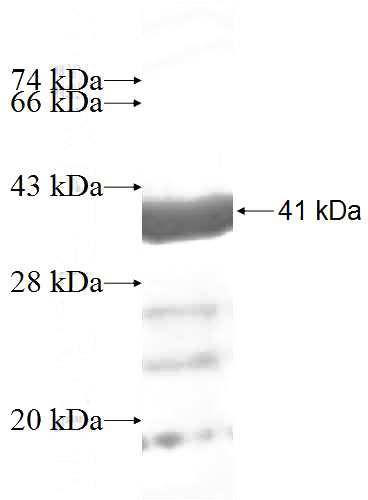 Recombinant Human STIP1 SDS-PAGE