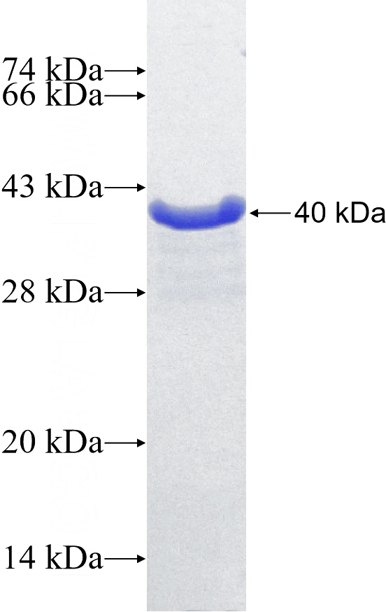Recombinant Human DOC2A SDS-PAGE