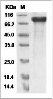 Rat HER4 / ErbB4 Protein (His Tag) SDS-PAGE