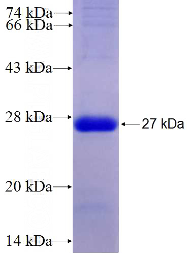Recombinant Human NFS1 SDS-PAGE