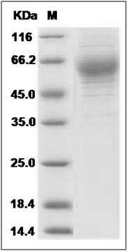 Rat HepaCAM2 Protein (His Tag) SDS-PAGE