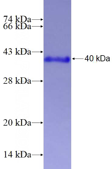 Recombinant Human SF3B14 SDS-PAGE