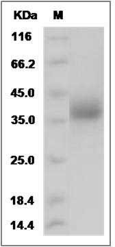 Rat LILRA5 Protein (His Tag) SDS-PAGE