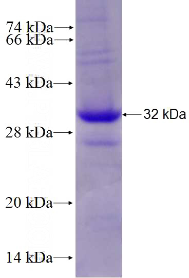 Recombinant Mouse Pecam1 SDS-PAGE