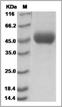Influenza A H7N3 (A/turkey/Italy/214845/2002) Hemagglutinin Protein (HA1 Subunit) (His Tag) SDS-PAGE