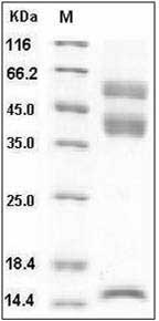 Human Latent TGF-beta 1 / TGFB1 Protein (His Tag) SDS-PAGE