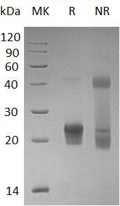 Human GGCT/C7orf24/CRF21 (His tag) recombinant protein