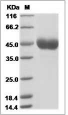 Influenza A H10N8 (A/Jiangxi-Donghu/346/2013) Hemagglutinin / HA1 Protein (His Tag)