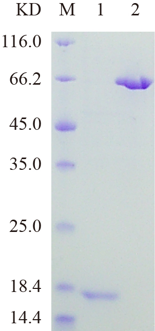 Recombinant CAC1G protein (His tag) SDS-PAGE