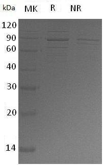 Human RPS6KA1/MAPKAPK1A/RSK1 (His tag) recombinant protein