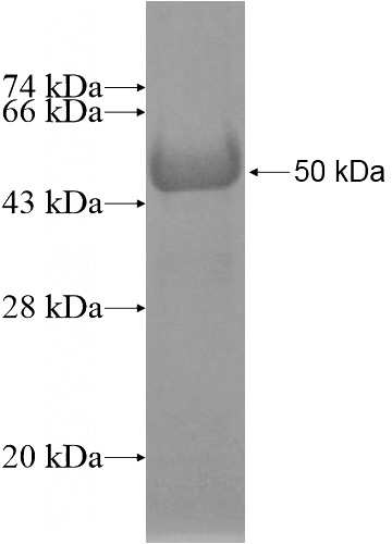 Recombinant Human PCDHAC2 SDS-PAGE
