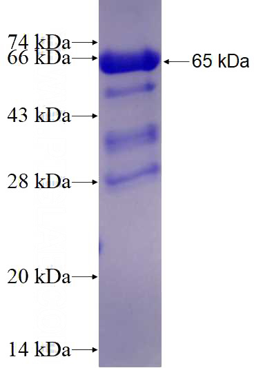 Recombinant Human RORB SDS-PAGE