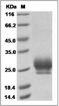 Human RNF43 Protein (His Tag) SDS-PAGE