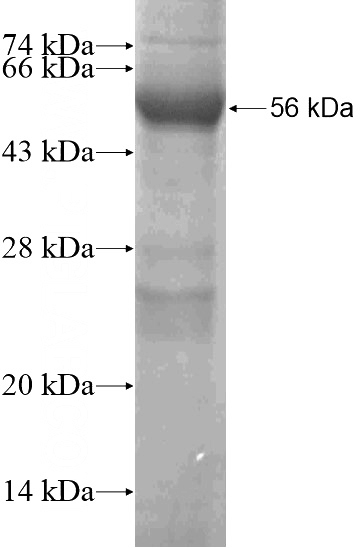 Recombinant Human LRRC50 SDS-PAGE