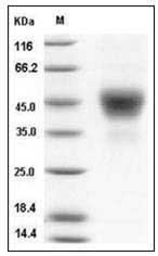 Human TROP2 / TACSTD2 Protein (His Tag) SDS-PAGE