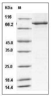 Human PTPRA / PTPalpha Protein (aa 174-793, His & GST Tag) SDS-PAGE