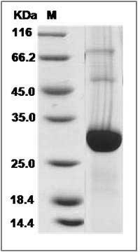 Mouse GLIPR1 / RTVP1 Protein (His Tag) SDS-PAGE
