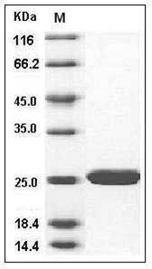 Human SOD2 / Mn-SOD Protein SDS-PAGE
