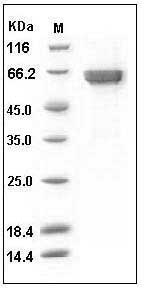 Human Ephrin-A3 / EFNA3 Protein (His & Fc Tag) SDS-PAGE