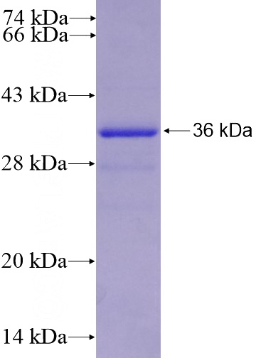 Recombinant Human HTR4 SDS-PAGE