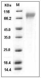 Human CD30 / TNFRSF8 Protein (His Tag) SDS-PAGE