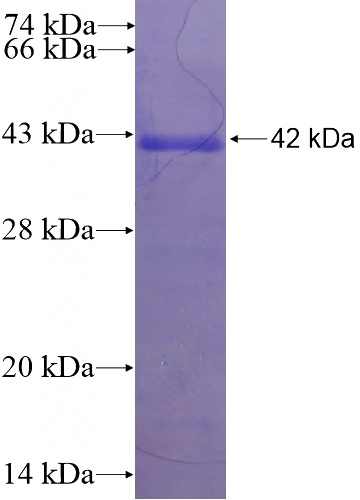 Recombinant Human PPP2R2A SDS-PAGE