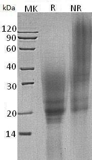 Cavia porcellus CTLA4 (His tag) recombinant protein