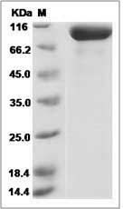 Human PSMA / FOLH1 Protein (His Tag)