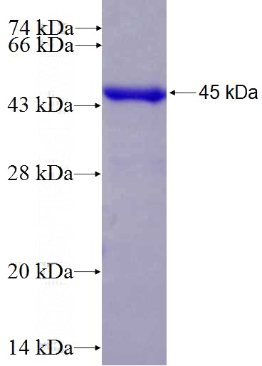 Recombinant Human PDS5B SDS-PAGE
