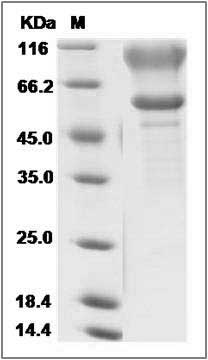 Rat SPN / CD43 / Sialophorin Protein (Fc Tag) SDS-PAGE
