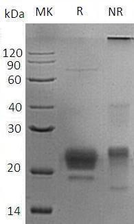 Human APOM/G3A/NG20/HSPC336 (His tag) recombinant protein