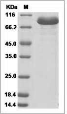 Human AMY2B Protein (Fc Tag) SDS-PAGE