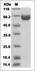 Influenza A H3N8 (A/equine/Gansu/7/2008) Hemagglutinin Protein (HA Subunit) (His Tag) SDS-PAGE