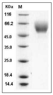 Mouse SerpinA6 / CBG Protein (His Tag) SDS-PAGE