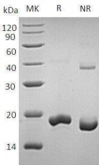 Human UBE2B/RAD6B recombinant protein
